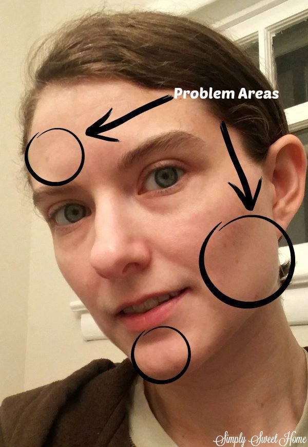 Bare Face Problem Areas